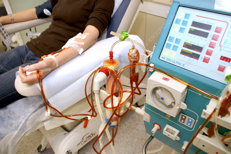 Kidney Dialysis - Best Dialysis Center in Dhaka